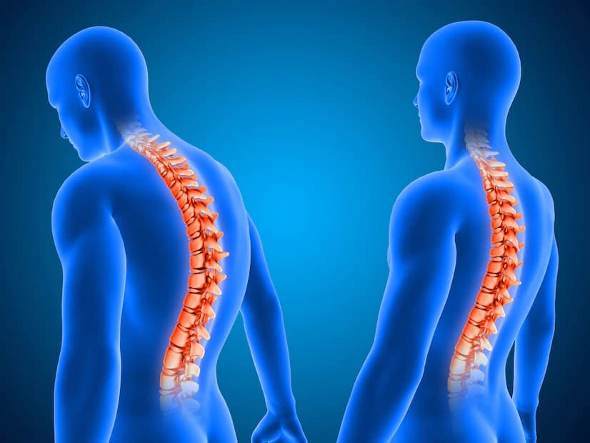 imagem ilustrativa de uma coluna vertebral